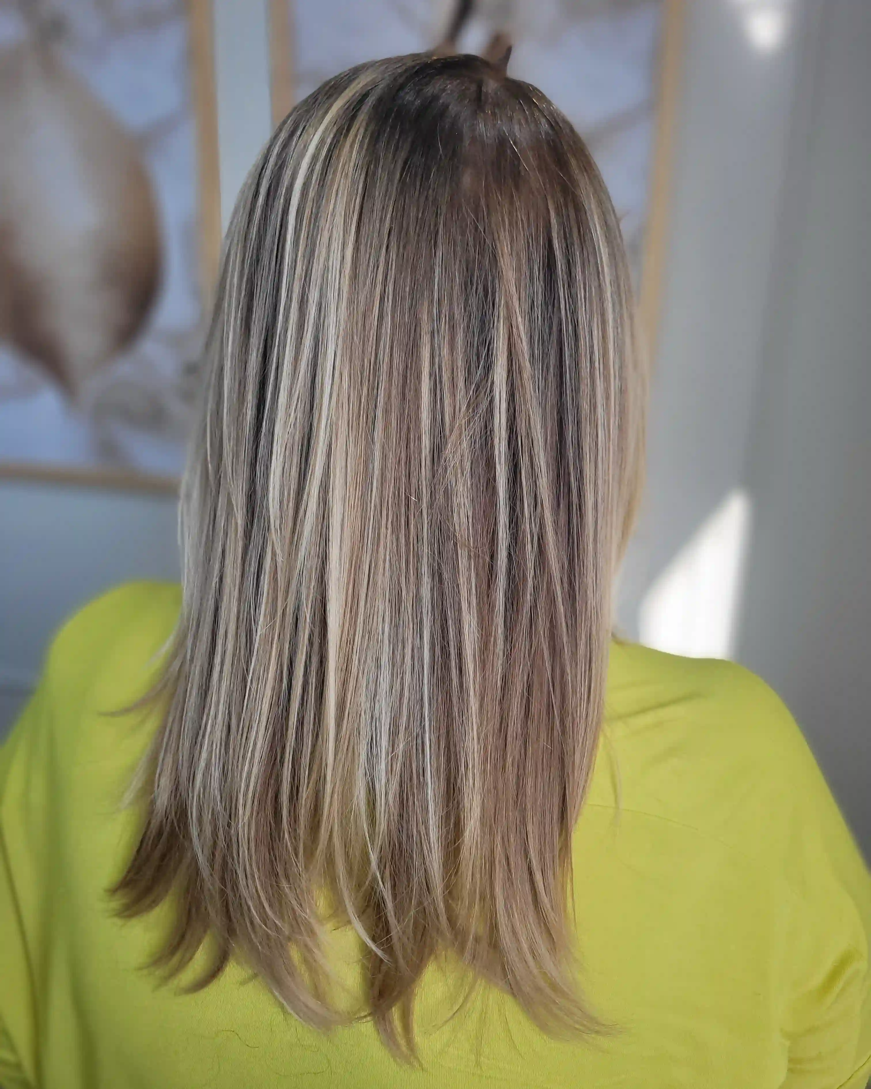 Antes e depois — tratamento de alopecia androgenética feminina em 6 Sessões — Rapha Beauty Tatuapé (Depois)